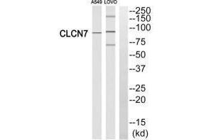 Western blot analysis of extracts from A549 cells and LOVO cells, using CLCN7 antibody. (CLCN7 抗体  (N-Term))