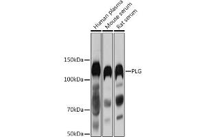 Western blot analysis of extracts of various cell lines, using PLG antibody (ABIN1682202, ABIN3017690, ABIN3017692 and ABIN6220212) at 1:1000 dilution. (PLG 抗体  (AA 20-300))