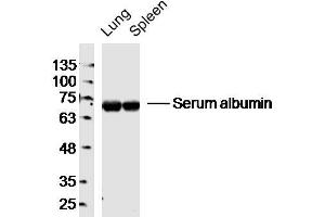 Lane 1: Mouse Lung lysates Lane 2: Mouse Spleen lysates probed with Serum albumin Polyclonal Antibody, Unconjugated  at 1:300 dilution and 4˚C overnight incubation.