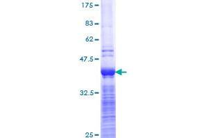 ABCC2 Protein (AA 214-313) (GST tag)