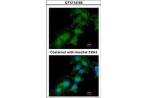 Image no. 3 for anti-ATPase, H+ Transporting, Lysosomal Accessory Protein 2 (ATP6AP2) (AA 146-320) antibody (ABIN467627)