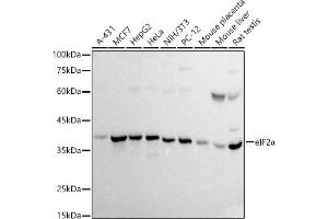 Western blot analysis of extracts of various cell lines, using eIF2α antibody (ABIN3021126, ABIN3021127, ABIN5663762 and ABIN6213983) at 1:500 dilution. (EIF2S1 抗体  (AA 1-260))