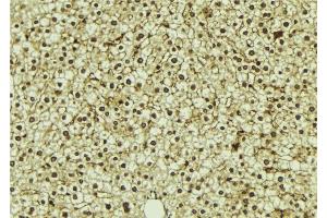 ABIN6273311 at 1/100 staining Mouse liver tissue by IHC-P. (ROGDI 抗体)
