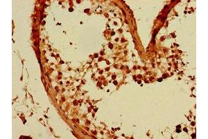 Immunohistochemistry of paraffin-embedded human testis tissue using ABIN7153725 at dilution of 1:100 (GFRA3 抗体  (AA 32-236))