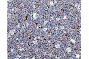 IHC analysis of NOXA2/p67phox/NCF2 using anti-NOXA2/p67phox/NCF2 antibody (ABIN7599462).