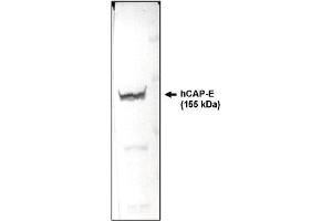 Western Blotting (WB) image for anti-Structural Maintenance of Chromosomes 2 (SMC2) (AA 523-768) antibody (ABIN264446) (SMC2 抗体  (AA 523-768))