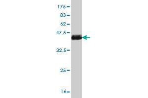 Western Blotting (WB) image for anti-Signal Transducer and Activator of Transcription 6, Interleukin-4 Induced (STAT6) (AA 694-801) antibody (ABIN563038)