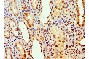 Immunohistochemistry of paraffin-embedded human kidney tissue using ABIN7143011 at dilution of 1:100 (PHAP1 抗体  (AA 1-170))