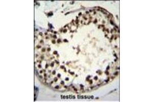 Immunohistochemistry (Paraffin-embedded Sections) (IHC (p)) image for anti-Additional Sex Combs Like 1 (ASXL1) (AA 521-549) antibody (ABIN950543)