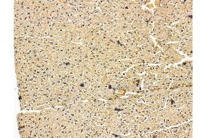 ABIN7096031 and ABIN7100093 at 1/100 staining mouse liver tissue by IHC-P. (DENND1A 抗体)