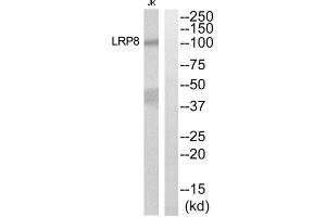 Western blot analysis of extracts from Jurkat cells, using LRP8 antibody. (LRP8 抗体  (Internal Region))