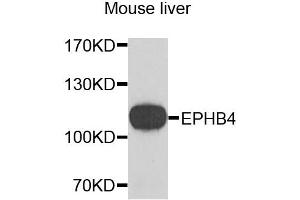 Western blot analysis of extracts of mouse liver, using EPHB4 antibody. (EPH Receptor B4 抗体)
