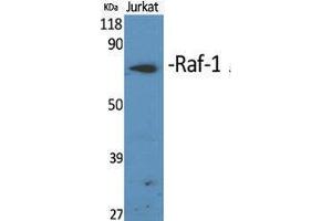 Western Blotting (WB) image for anti-V-Raf-1 Murine Leukemia Viral Oncogene Homolog 1 (RAF1) (Thr566) antibody (ABIN3177117) (RAF1 抗体  (Thr566))