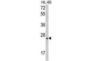 Western blot analysis of SFRS1 Antibody (C-term) in HL-60 cell line lysates (35ug/lane). (SRSF1 抗体  (C-Term))