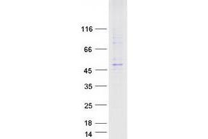 Validation with Western Blot