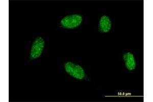 Immunofluorescence of monoclonal antibody to ATOH1 on HeLa cell. (ATOH1 抗体  (AA 266-354))
