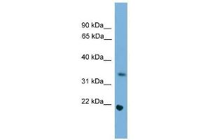 Western Blot showing Sohlh1 antibody used at a concentration of 1-2 ug/ml to detect its target protein. (SOHLH1 抗体  (Middle Region))