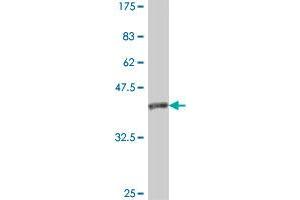 Western Blot detection against Immunogen (38. (Transportin 1 抗体  (AA 25-141))