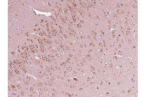 Immunohistochemistry (Paraffin-embedded Sections) (IHC (p)) image for anti-Proto-oncogene tyrosine-protein kinase Src (Src) (AA 2-100) antibody (ABIN738171)