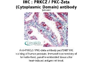 Image no. 1 for anti-Protein Kinase C, zeta (PRKCZ) (1st Cytoplasmic Domain) antibody (ABIN1738343) (PKC zeta 抗体  (1st Cytoplasmic Domain))