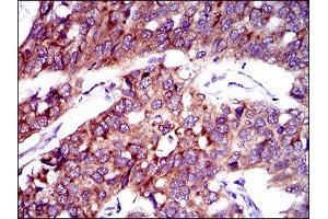 Immunohistochemistry (IHC) image for anti-Solute Carrier Family 27 (Fatty Acid Transporter), Member 2 (SLC27A2) (AA 346-405) antibody (ABIN1845739)