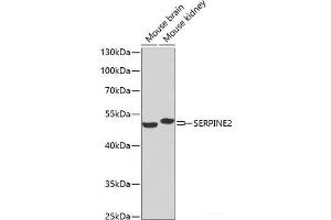 Western blot analysis of extracts of various cell lines using SERPINE2 Polyclonal Antibody at dilution of 1:1000. (SERPINE2 抗体)