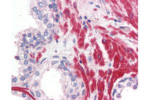 Immunohistochemistry (IHC) image for anti-Olfactory Receptor, Family 51, Subfamily E, Member 1 (OR51E1) (Internal Region) antibody (ABIN1049182)