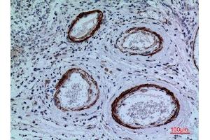 Immunohistochemistry (IHC) analysis of paraffin-embedded Human Brain, antibody was diluted at 1:100. (CYP11A1 抗体  (C-Term))