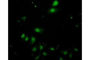 Detection of IL17RC in Human HepG2 Cells using Polyclonal Antibody to Interleukin 17 Receptor C (IL17RC) (IL17RC 抗体  (AA 257-477))