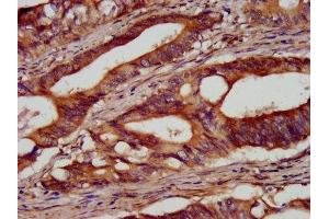 Immunohistochemistry (IHC) image for anti-SEL1L adaptor subunit of ERAD E3 ubiquitin ligase (SEL1L) (AA 22-181) antibody (ABIN7166102)