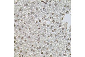Immunohistochemistry of paraffin-embedded mouse liver using ZNF408 antibody (ABIN5974874) at dilution of 1/100 (40x lens). (ZNF408 抗体)