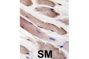 Formalin-fixed and paraffin-embedded human skeletal muscle tissue reacted with PIK3R1 polyclonal antibody  , which was peroxidase-conjugated to the secondary antibody, followed by DAB staining. (PIK3R1 抗体  (Tyr580))