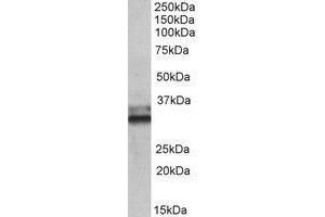 AP22411PU-N ETFA antibody staining of Human Colon lysate at 0. (ETFA 抗体  (Internal Region))