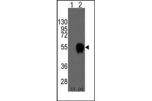 Western blot analysis of CD14(arrow) using rabbit polyclonal CD14 Antibody (CD14 抗体  (N-Term))