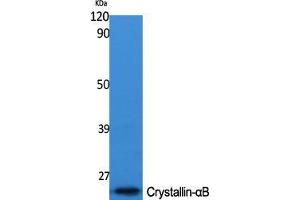 Western Blot (WB) analysis of specific cells using Crystallin-alphaB Polyclonal Antibody.