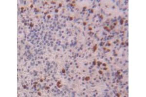 Used in DAB staining on fromalin fixed paraffin- embedded Kidney tissue (NCF4 抗体  (AA 132-339))