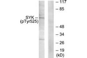 Western blot analysis of extracts from A549 cells, using SYK (Phospho-Tyr525) Antibody.