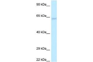 WB Suggested Anti-LGI1 Antibody Titration: 1. (LGI1 抗体  (N-Term))