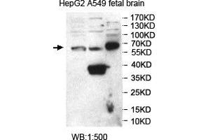 Western blot analysis of HepG2, A549 and fetal brain lysates, using SNTG2 antibody. (SNTG2 抗体  (AA 143-324))