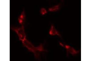 ABIN6275335 staining K562 by IF/ICC. (OAT 抗体  (Internal Region))