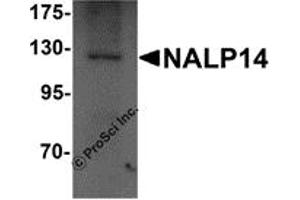 Western Blotting (WB) image for anti-NLR Family, Pyrin Domain Containing 14 (NLRP14) (N-Term) antibody (ABIN1031469) (NLRP14 抗体  (N-Term))