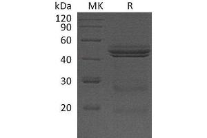 Western Blotting (WB) image for Interleukin 12 (IL12) protein (ABIN7320573) (IL12 蛋白)