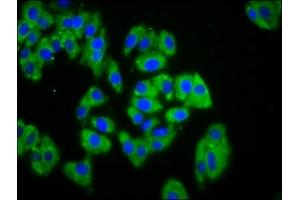Immunofluorescence staining of HepG2 cells with ABIN7167509 at 1:133, counter-stained with DAPI. (PTPRK 抗体  (AA 589-749))
