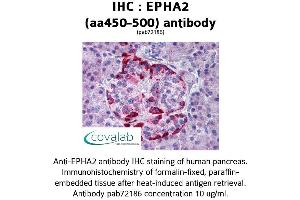 Image no. 1 for anti-EPH Receptor A2 (EPHA2) (AA 450-500) antibody (ABIN1734074) (EPH Receptor A2 抗体  (AA 450-500))