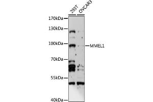 Western blot analysis of extracts of various cell lines, using MMEL1 antibody (ABIN6293386) at 1:1000 dilution. (MMEL1 抗体)