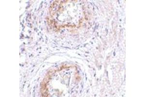 Immunohistochemistry of TEM5 in human bladder tissue with this product at 5 μg/ml. (GPR124 抗体  (C-Term))