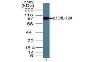 Image no. 1 for anti-Interleukin 12 alpha (IL12A) (AA 200-250) antibody (ABIN960224) (IL12A 抗体  (AA 200-250))