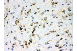 Immunohistochemistry (IHC) image for anti-Peroxiredoxin 4 (PRDX4) (AA 178-2081), (C-Term) antibody (ABIN3043905)