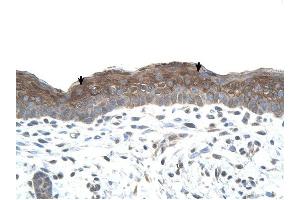 LOC400856 antibody was used for immunohistochemistry at a concentration of 4-8 ug/ml to stain Squamous epithelial cells (arrows) in Human Skin. (LOC400856 抗体  (C-Term))