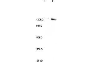 L1 rat brain, L2 human colon carcinoma lysates probed (ABIN741705) at 1:200 in 4 °C. (SREBF2 抗体)